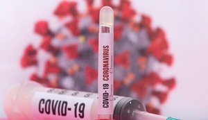 В Украине за сутки от COVID-19 умерли 133 человека, зафиксированы 3 620 новых случаев заражения, свыше 2 тыс. госпитализированы