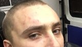 Екс-глава одеського Правого сектора Стерненко звинуватив мера Труханова в організації нападу на нього. ФОТО