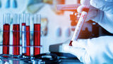 Ukraine confirms 321 coronavirus cases in past 24 hours