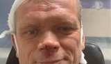 Ексміністр Швайка заявив про побиття: "Копаєш ділянку, травичку плануєш посіяти, вибігають двоє з бітами". ФОТО