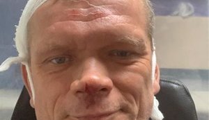 Экс-министр Швайка заявил об избиении: "Копаешь участок, травку планируешь посеять, выбегают двое с битами". ФОТО