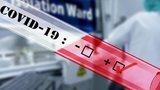 Kyiv residential care home in Darnytsky district diagnoses 81 people with COVID-19 – Klitschko
