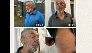 На Ривненщине заявили об избиении 61-летнего "афганца": полиция открыла производство, ТЦК проводит проверку. ВИДЕО