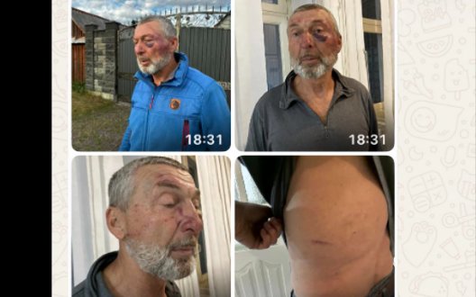 На Рівненщині заявили про побиття 61-річного