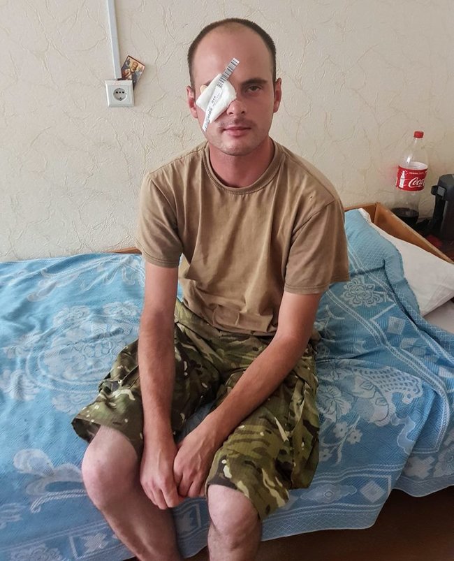 Військовослужбовцю Олександру Молчанову, пораненому в зоні ООС, потрібна допомога в лікуванні: куля пройшла через око, застрягши в решітчастих пазухах носа, - волонтер Танцюра 01