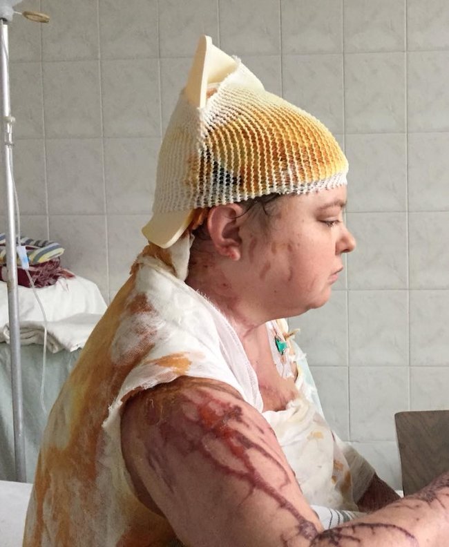 Сьогодні річниця смерті активістки Гандзюк 01