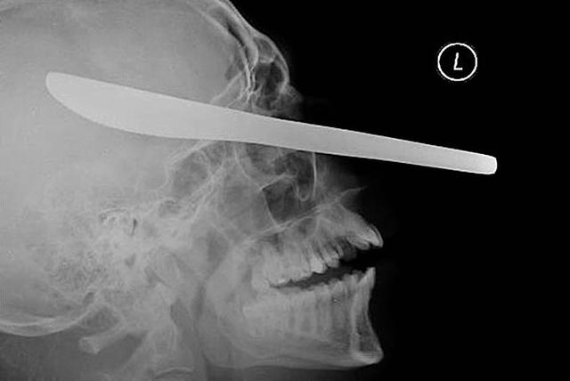 Цензор.НЕТ Изображение