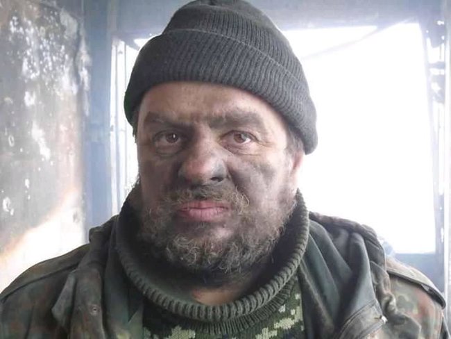 Журналистка Цензор.НЕТ Бурлакова просит украинцев помочь больному киборгу Игорю Гофману 01