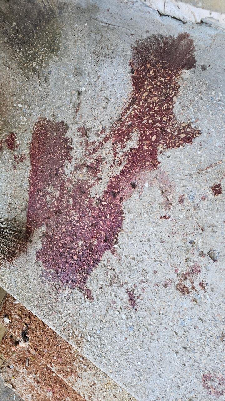 РФ нанесла удар по больнице в Херсоне: пострадали 4 сотрудника