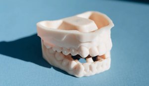 Зуби як розкіш: війна перетворила стоматологію Росії на ринок самолікування та тіньових клінік