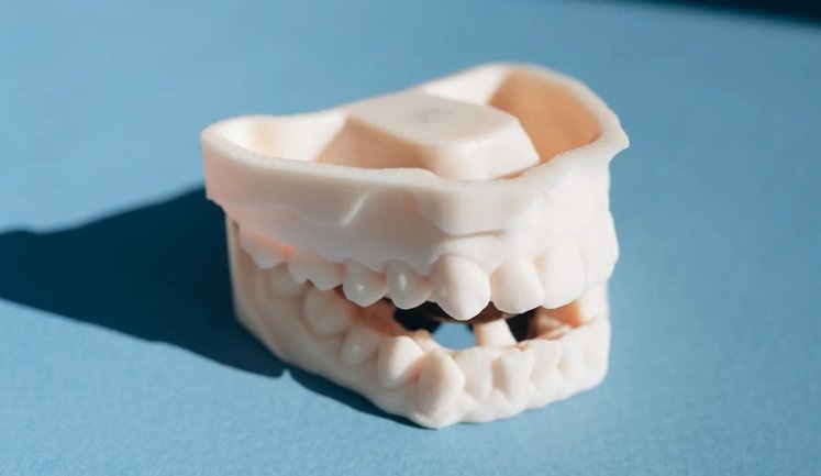 Зуби як розкіш: війна перетворила стоматологію Росії на ринок самолікування та тіньових клінік