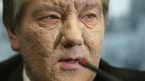 У ГПУ нет доказательств умышленного отравления Ющенко - если не сдаст кровь, дело закроют, - Кузьмин