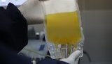 Ефективність лікування COVID-19 плазмою крові перехворілих поки не доведена, - ВООЗ
