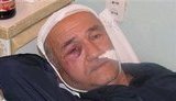 Нападение на представителя Курултая угрожает этнополитической стабильности в Крыму, - Джемилев