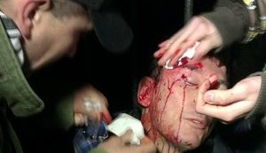 "Беркут" избил Луценко. ФОТОрепортаж