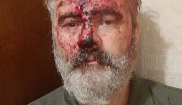 Возле Михайловского собора напали на митрополита Климента, военнослужащего ВСУ. Нацполиция устанавливает обстоятельства происшествия (обновлено). ФОТО