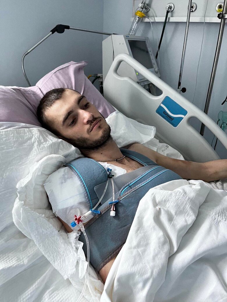 Важко пораненому воїну 57-ї ОМПБр Антону Вишневському потрібна допомога 03