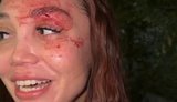 Россиянка потеряла сознание в очереди за бензином на АЗС в Челябинске и разбила лицо: "Меня никто не отп#здил"