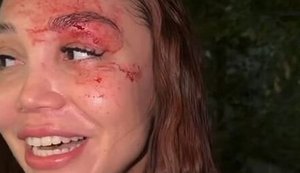 Россиянка потеряла сознание в очереди за бензином на АЗС в Челябинске и разбила лицо: "Меня никто не отп#здил"