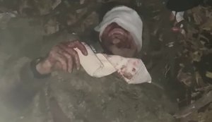 Окупанти залишилися без бліндажа, взуття та пальців на ногах після "зустрічі" з українським дроном. ВIДЕО