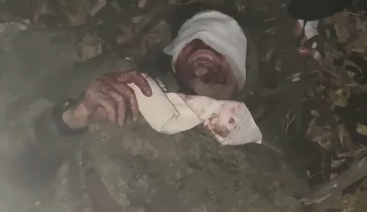 Окупанти залишилися без бліндажа, взуття та пальців на ногах після "зустрічі" з українським дроном. ВIДЕО