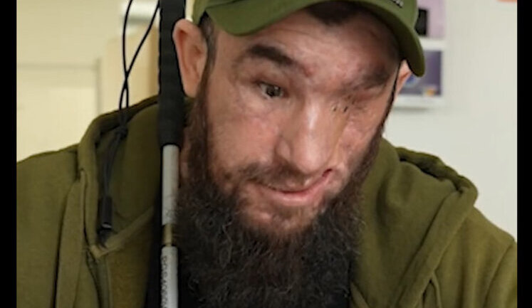I’m glad to be alive, and fact that I can’t see, I’ve seen a lot in my life, - Ukrainian soldier Pavlo undergoing rehabilitation after losing his sight due to injury. VIDEO