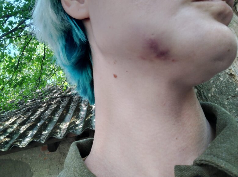 П’яний майор ТЦК в Ужгороді побив дружину воїна ЗСУ 03