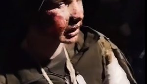 Прикордонники взяли в полон обпеченого окупанта. ВIДЕО