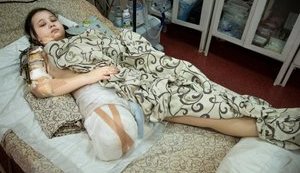 Ежедневно из-за российской агрессии тяжело травмируются сотни украинцев, - Зеленская. ФОТОрепортаж