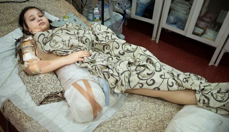 Ежедневно из-за российской агрессии тяжело травмируются сотни украинцев, - Зеленская. ФОТОрепортаж