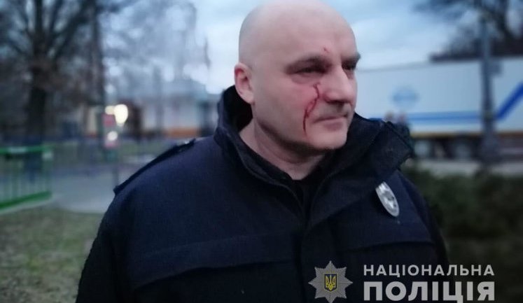 Після зіткнень у Черкасах у лікарню звернулися 22 поліцейські, 19 із них - госпіталізовано, - МВС. ВIДЕО