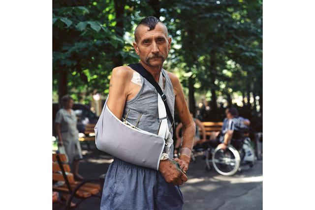 Проект українського фотографа Чекменьова зі знімками поранених воїнів зібрав близько $ 400000 для їх лікування і підтримки 18