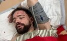 Лаборанта львівського університету Степана Більченка побили під час мобілізації у Львові
