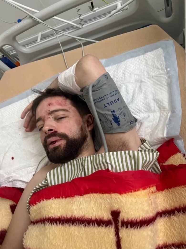 Працівника Львівського університету знайшли побитим: ТЦК відреагував