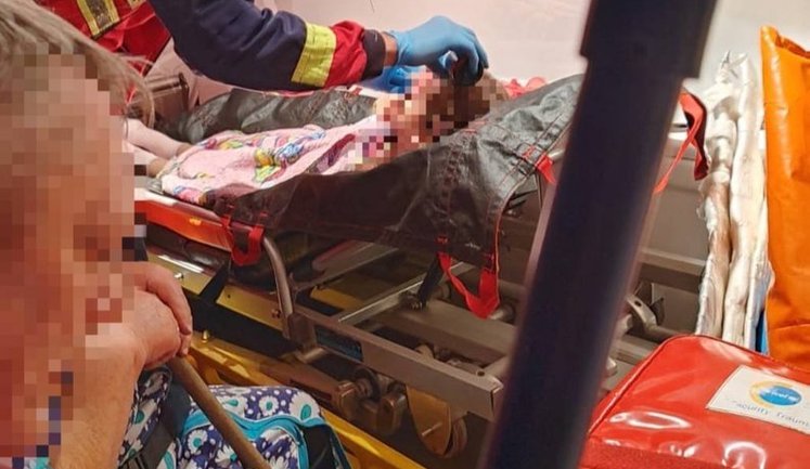 Поранена у Куп’янську 6-річна дівчинка у важкому стані, з’ясовується, чому її не евакуювали. ФОТО