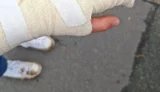 "Муніципальна охорона" силою відтягувала активістів під час протесту на Теремках, жінка травмувала руку: поліція проводить перевірку. ВІДЕО+ФОТОрепортаж