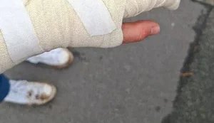 "Муніципальна охорона" силою відтягувала активістів під час протесту на Теремках, жінка травмувала руку: поліція проводить перевірку. ВІДЕО+ФОТОрепортаж