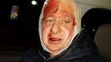 журналисты избиение