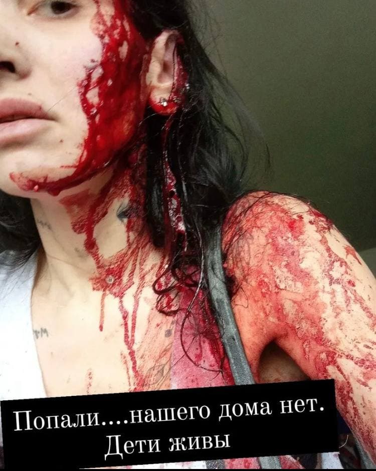 Окровавленная, на руках дети, какой-то апокалипсис, - жительница Чернигова, пережившая бомбардировку российской авиацией 02