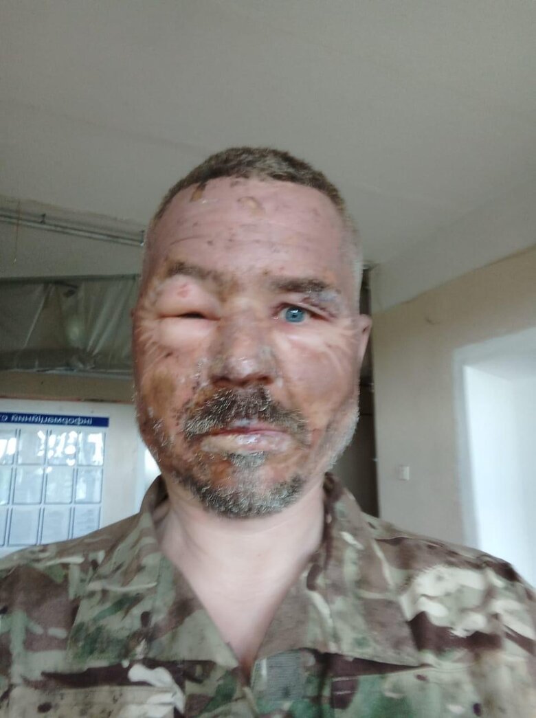 Поранені добровольці