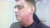 Игорь Кобзарь: "Спасибо сотруднику "Беркута", подложившему под мою разбитую голову чью-то ногу…"
