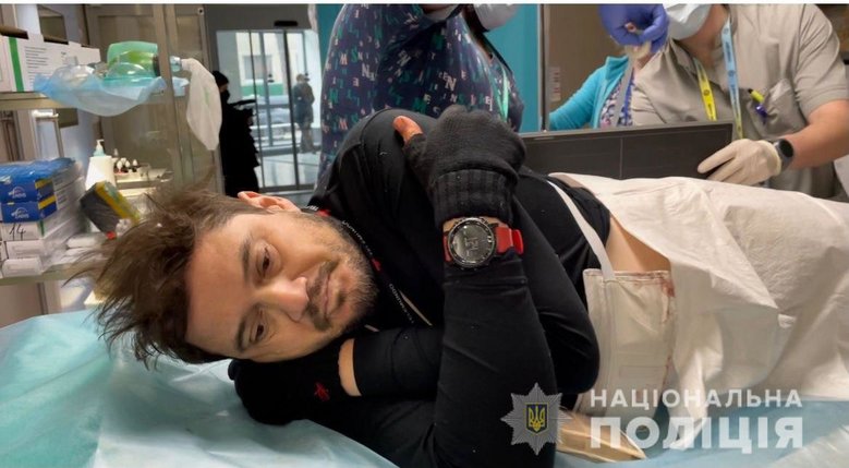 Життю пораненого в Ірпені американського журналіста нічого не загрожує, - Нацполіція 01