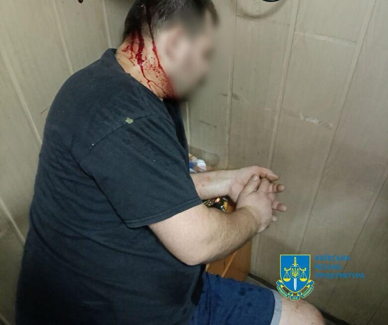 Наслідки атаки РФ на Київ