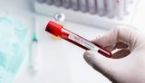 32 health workers contract coronavirus in Ternopil region
