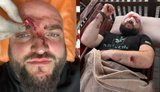 Мужчина избил военного арматурой из-за замечания о музыке РФ