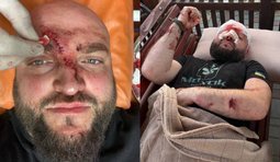 Чоловік арматурою побив військового через зауваження про музику РФ