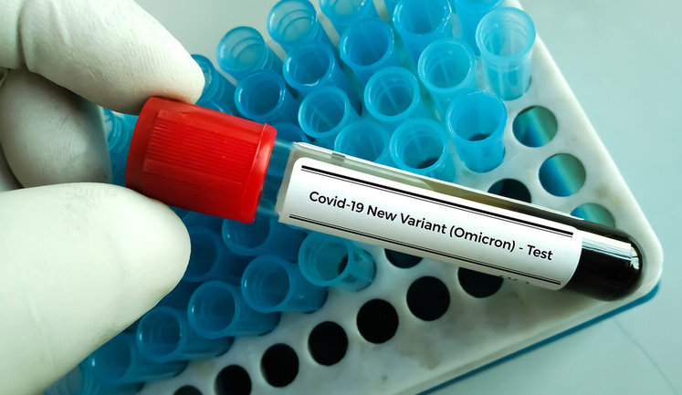 У Києві стрімко зростає захворюваність на COVID-19: За тиждень зафіксовано 1283 випадки