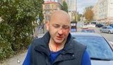 Учасника АТО і колишнього полоненого Дєєва з дружиною побили в центрі Києва. ВIДЕО