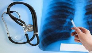 Рівень захворюваності на туберкульоз в Україні перевищує епідемічний поріг!