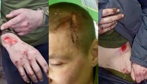 Десятки смертей новобранців встановили журналісти у полку Скеля
